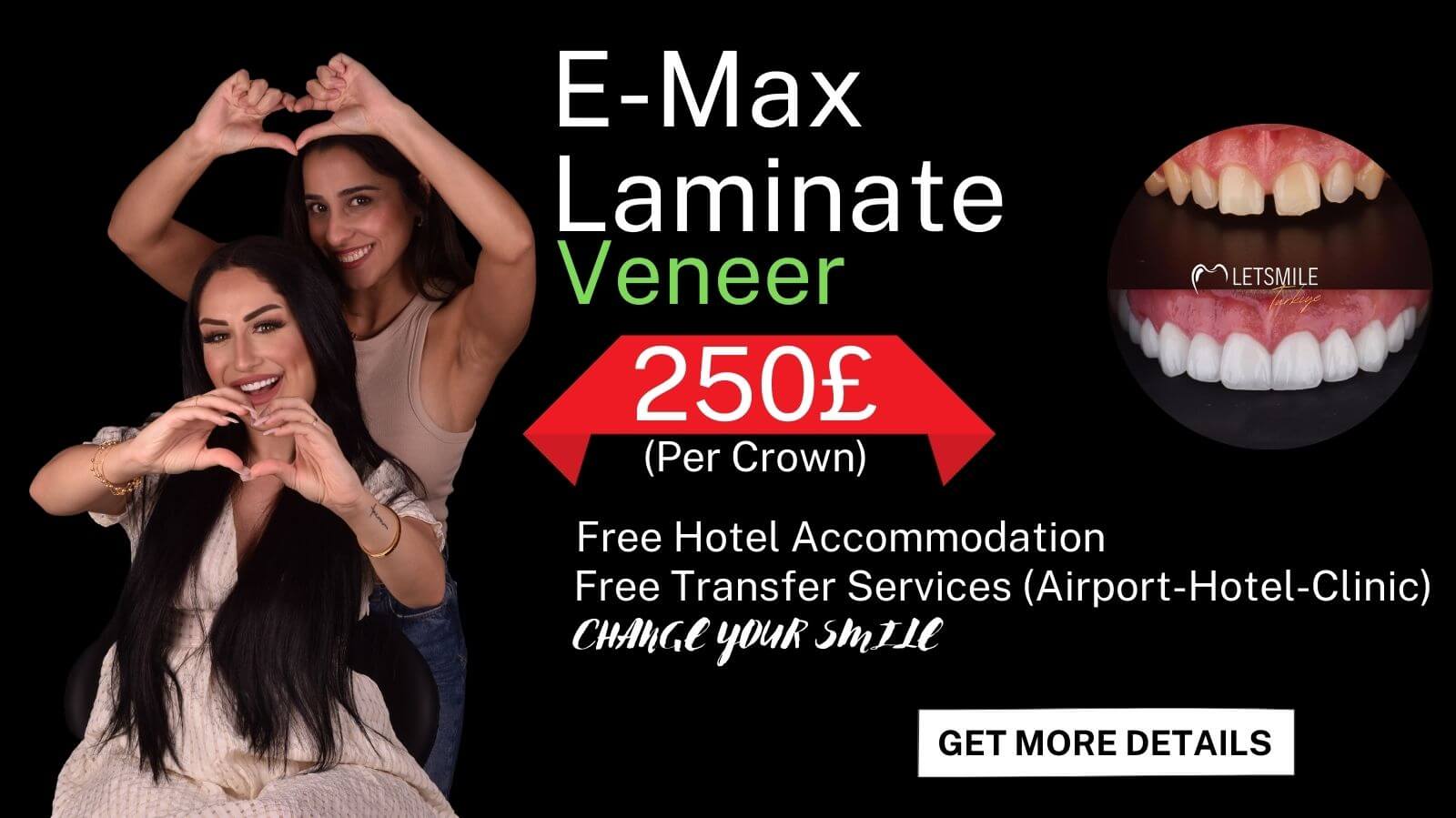 E-MAX LAMINATE VENEERS smile makeover
